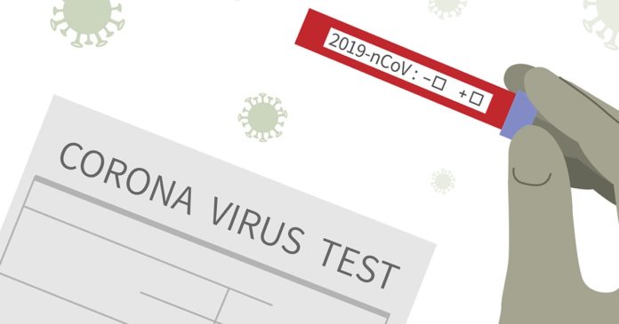 Coronavirus: केवल सरकारी ही नहीं बल्कि इन प्राइवेट लैब्स में कराएं अपना Test Coronavirus: केवल सरकारी ही नहीं बल्कि इन प्राइवेट लैब्स में कराएं अपना Test