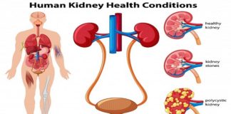 आपको हो सकती है किडनी की बीमारी, यदि आप महसूस कर रहें हैं ये लक्षण (Functions, Treatment and Symptoms of Kidney Disease in Hindi) आपको हो सकती है किडनी की बीमारी, यदि आप महसूस कर रहें हैं ये लक्षण (Functions, Treatment and Symptoms of Kidney Disease in Hindi)