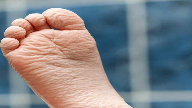 आप जानते हैं ज्यादा देर पानी में काम करने से उंगलियां क्यों सिकुड़ जाती हैं?