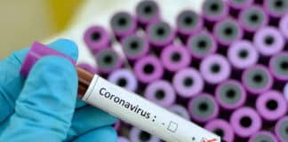 आप जानतें है Coronavirus का Test कैसे किया जाता है, जानें इसकी सारी डिटेल आप जानतें है Coronavirus का Test कैसे किया जाता है, जानें इसकी सारी डिटेल