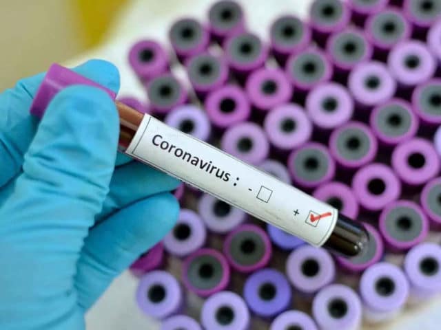 आप जानतें है Coronavirus का Test कैसे किया जाता है, जानें इसकी सारी डिटेल