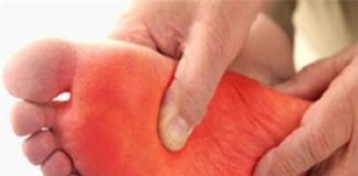 जानिए पैरों के तलवे में जलन को दूर करने के आसान घरेलु उपाय pair jalan